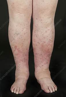 Skin Layer And Mid Layer Clothing